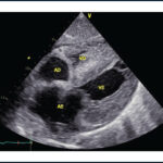 Figura 6