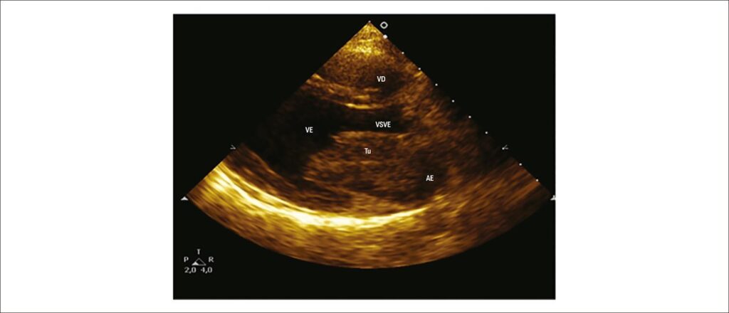 Figura 5