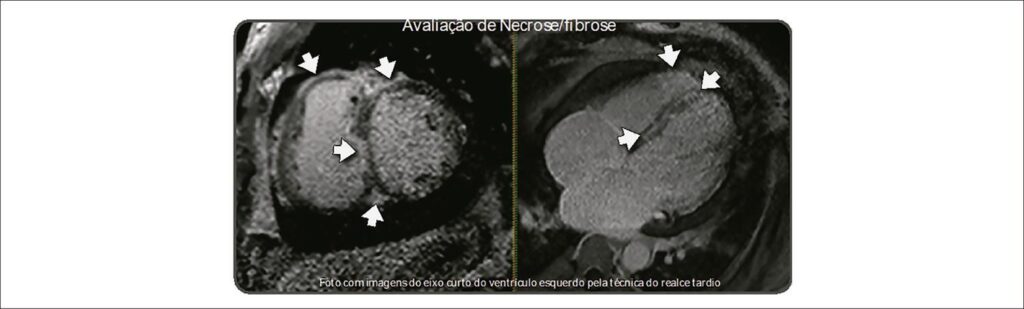 Figura 2