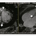 Figura 2