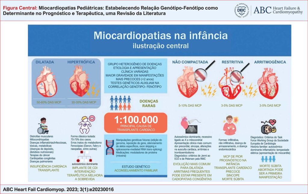 As principais características de cada fenótipo das miocardiopatias pediátricas. CDI: cardioversor desfibrilador implantável; ECO: ecocardiografia; MCP: miocardiopatia; RMC: ressonância magnética cardíaca.