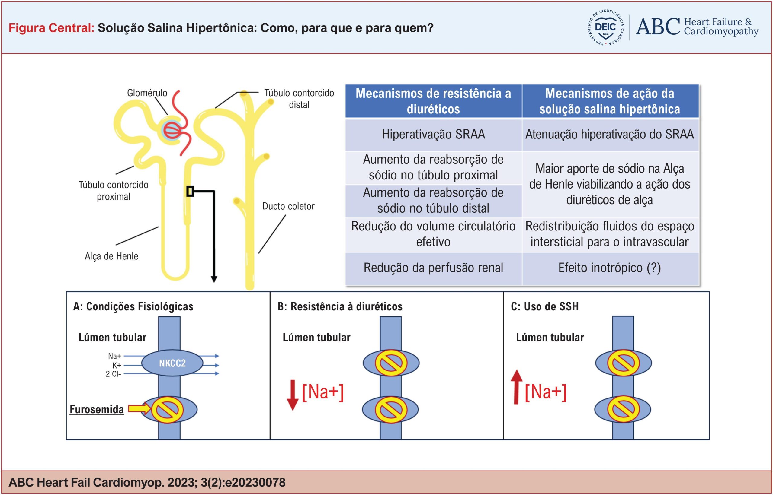 Solução Salina Hipertônica: Como, Para Que e Para Quem?