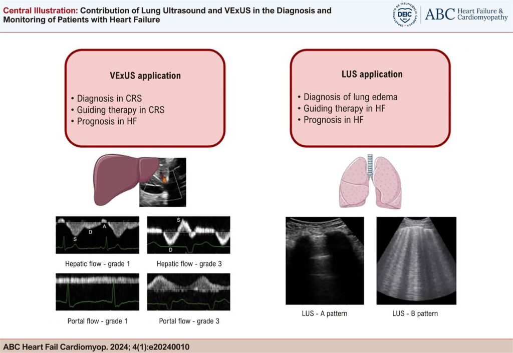 VExUS and LUS application in Heart Failure. VExUS: Venous Excess Ultrasound; LUS: lung ultrasound; CRS: cardiorenal syndrome; HF: heart failure.