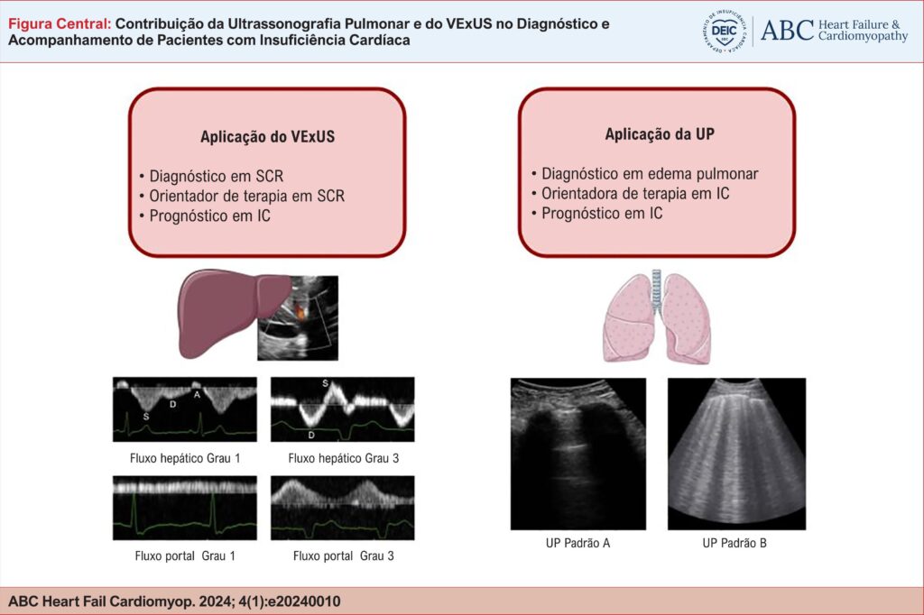 Aplicação VExUS e UP na insuficiência cardíaca. VExUS: Venous Excess Ultrasound Score; UP: ultrassonografia pulmonar; SCR: síndrome cardiorrenal; IC: insuficiência cardíaca.
