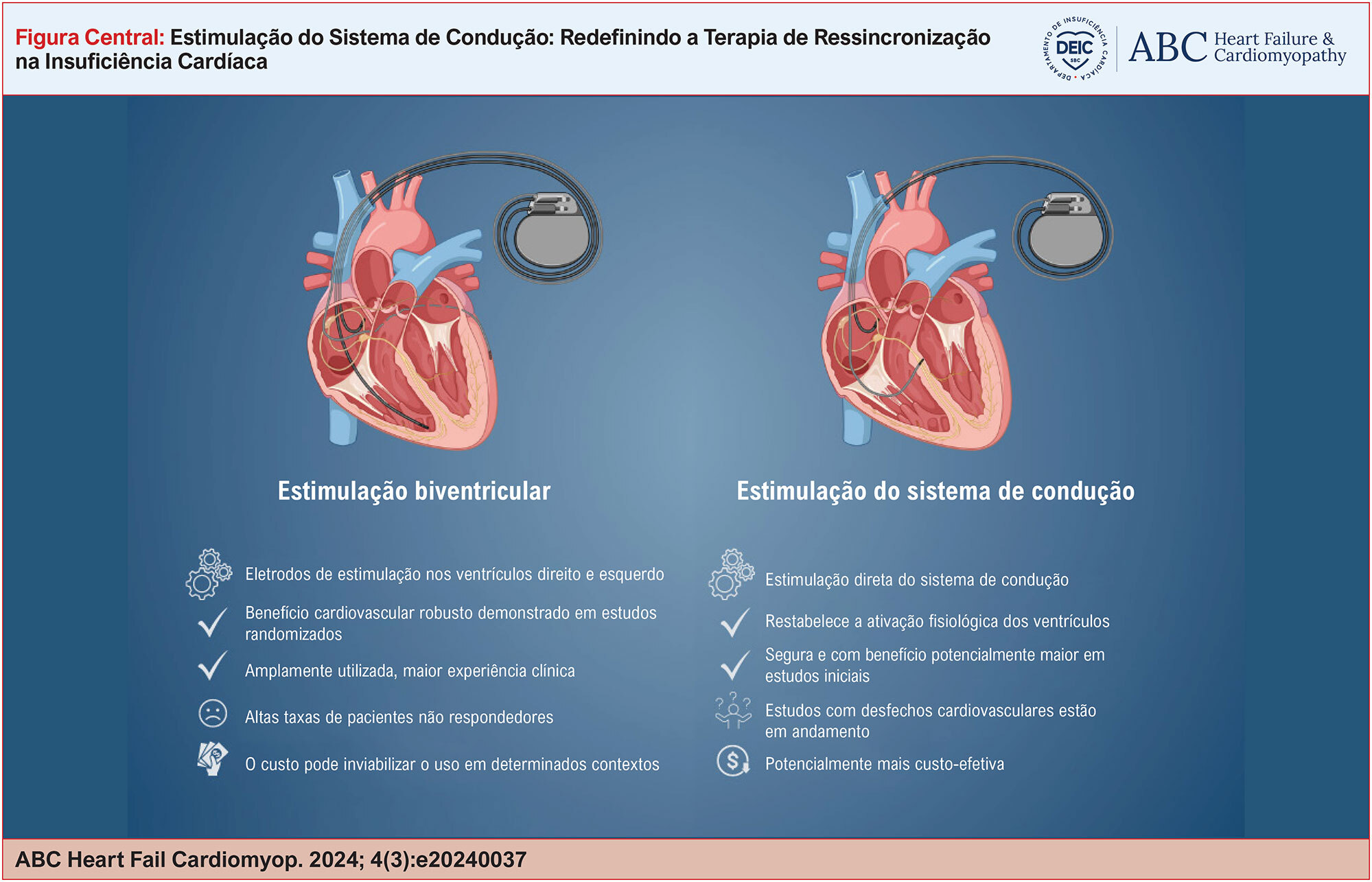 Estimulação do Sistema de Condução: Redefinindo a Terapia de Ressincronização na Insuficiência Cardíaca