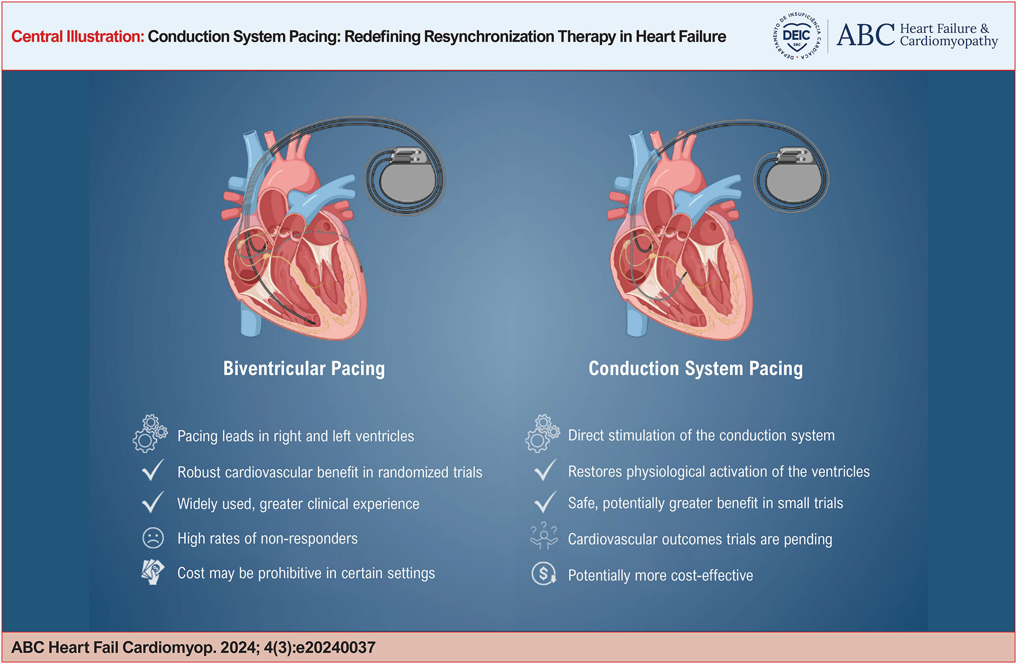 Conduction System Pacing: Redefining Resynchronization Therapy in Heart Failure