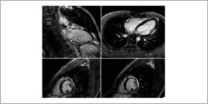 Figura 2