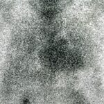 Figura 2
