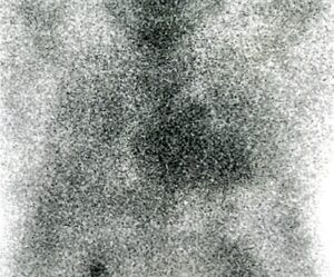 Figura 2