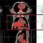 Figura 4