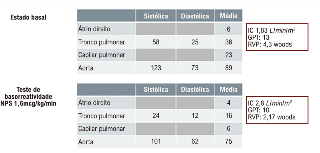 Figura 2