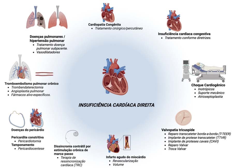 Figura Central