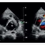 Figura 1